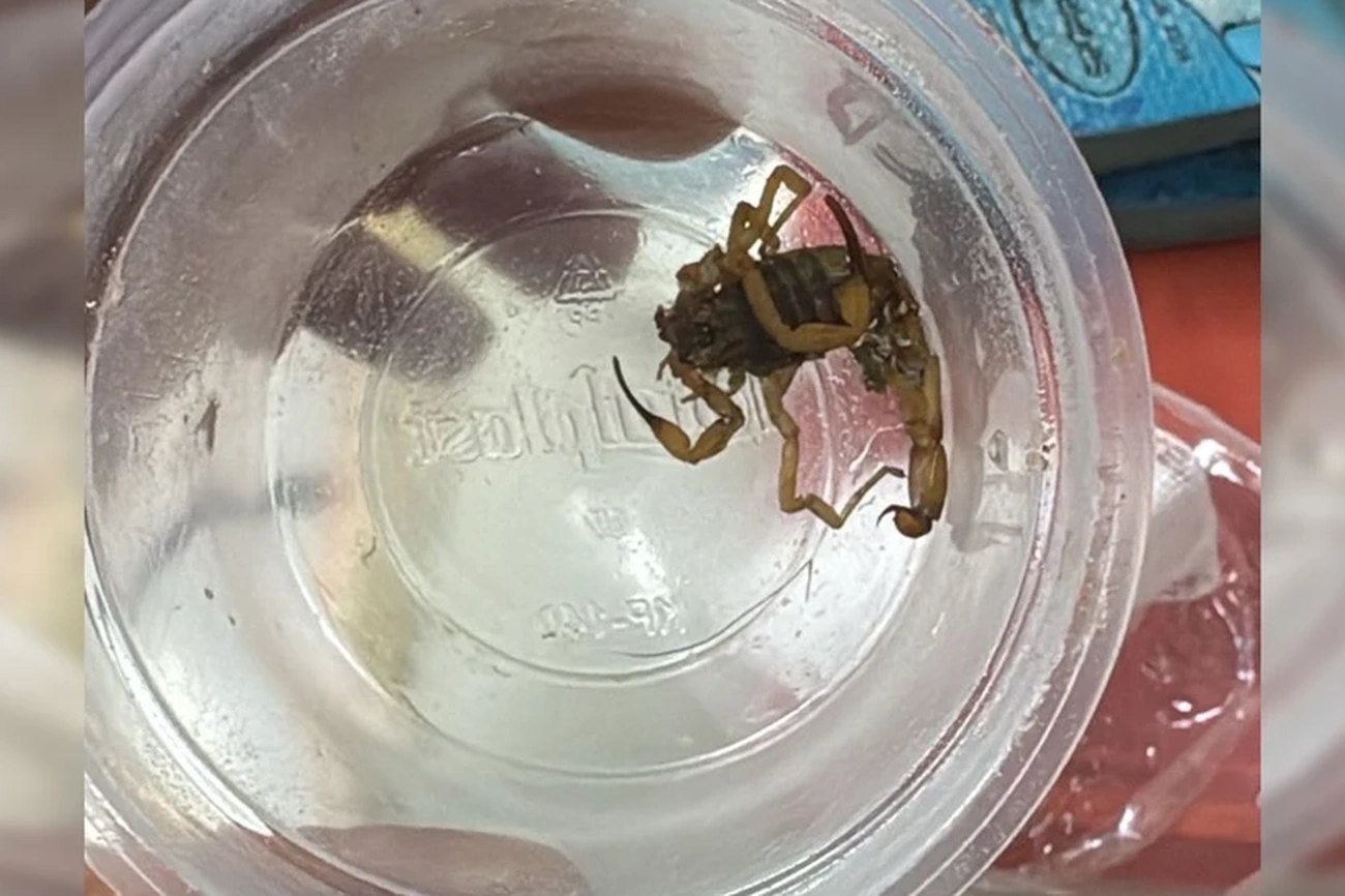 Brasília Child Stung by Scorpion Discharged Today After Fast Treatment