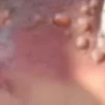 Pregnant Girlfriend Arrested for Scalding Boyfriend with Boiling Water Today