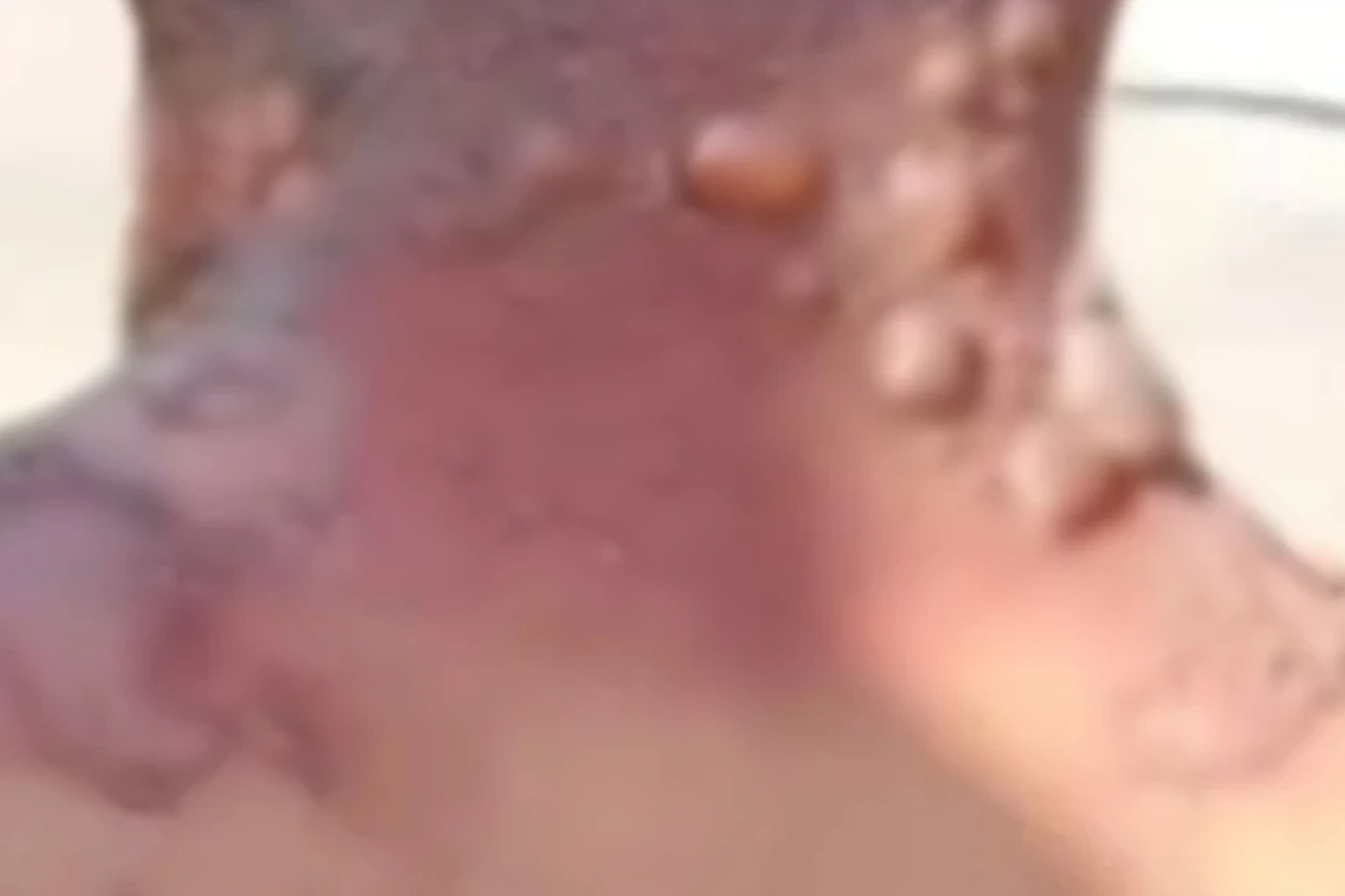 Pregnant Girlfriend Arrested for Scalding Boyfriend with Boiling Water Today