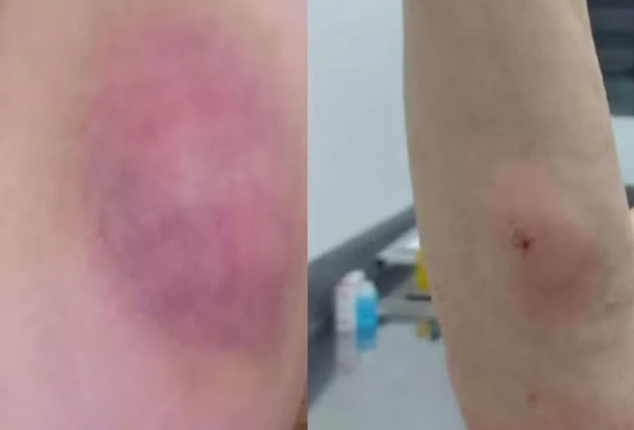 Woman Suffers Horrific Medical Error in Shocking Blunder at Veterinary Clinic